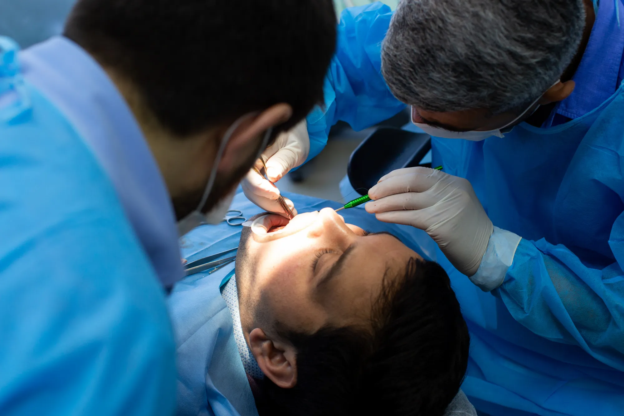 signs you need root canal treatment